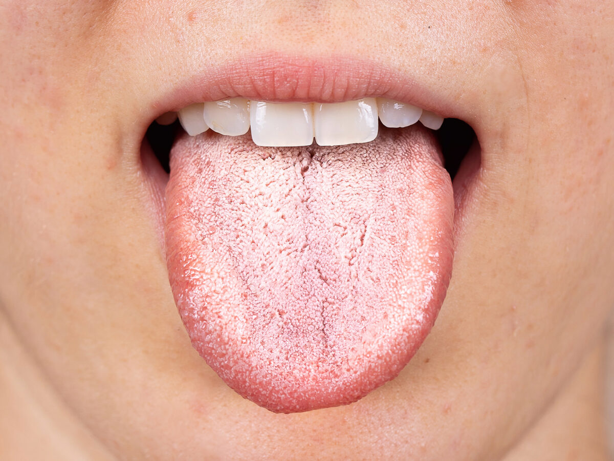 Why Do You Wake Up With a Dry Mouth?